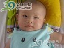 小儿低血糖