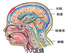小儿发烧