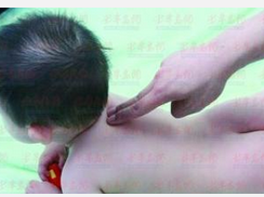 小儿脾外伤