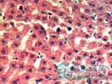 小儿糖原贮积病Ⅸ型