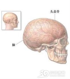小儿硬脑膜下血肿