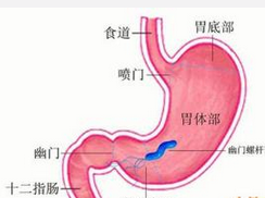 消化系统溃疡病