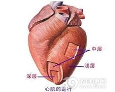 心肌梗塞并发心室间隔穿破