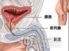 性交晕厥