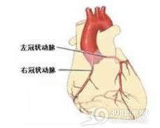 胸降主动脉动脉瘤