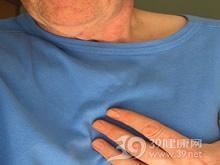 心力衰竭