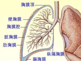 胸膜炎