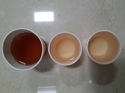血尿