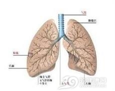 消散延迟性肺炎