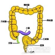 先天性巨结肠