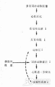 心源性休克