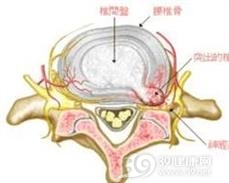 运动员胸背与腰背痛