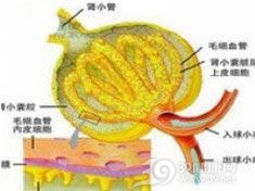 脂蛋白肾小球病