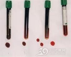 中毒性高铁血红蛋白血症