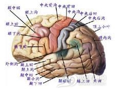自发性脑室内出血