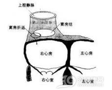 自律性房性心动过速