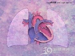 阻塞性肺气肿